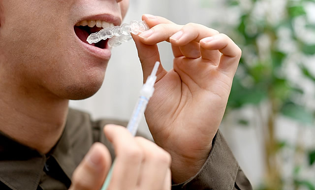 ホームホワイトニング